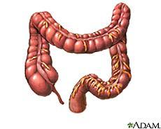 Intestinum crassum Colon 1-3 m Coecum +appendix intra C. ascendens - rerto C. transversum intra mesocolon C.