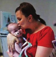 Rolikát még egy darabig megfigyelés alatt tartják az angol orvosok, a későbbiekben pedig újabb megpróbáltatások várnak a csöpp fiúra, mert a légcsőszűkület mellett további egészségügyi problémák is