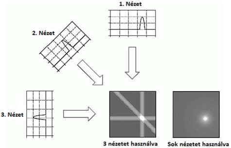 a b 4. ábra CT-felvétel rekonstrukciója három illetve több irányból rögzített jelsorozat alapján a) szűrés nélkül, és b) FBP-vel. (Smith, 1997) 5. ábra Rekonstrukciós algoritmusok (http://oftankonyv.
