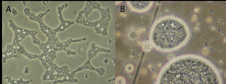 9. ábra: Az n-hexadekán tartalmú minimál tápoldatban szaporított R. erythropolis MK1 (A) és PR4 (B) törzsek fénymikroszkópos képe (400 x-os nagyítás).