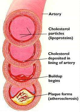Szterinek: 1.) állati eredetű szteroidok: a zooszterinek legfontosabb képviselője a koleszterin - szinte minden szövetből izolálható (pl.