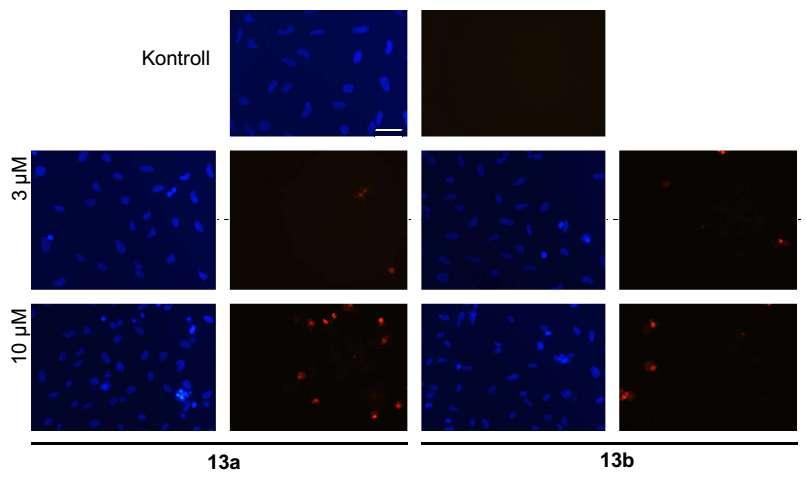 24 órás kezelés után mindkét alkaloid gátolta a BrdU HeLa sejtekbe történő beépülését, a 13a már 3 µm esetén is szignifikáns mértékben (46. ábra).