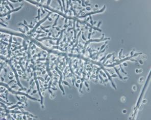Trichoderma longibrachiatum Forrás: Talaj, elhalt