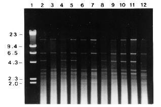 Penicillium marneffei tipizálása HaeIII RFLP 46 thaiföldi izolátumra (22 klinikai): két