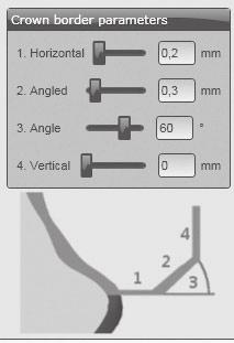 ALKALMAZÁS Szél-paraméterek a CAD-szoftverben Ügyeljen a szélek kielégítő vastagságára. A javasolt értékek a következők: 1. A szél vastagsága (Horizontal): 0,2 mm 2.