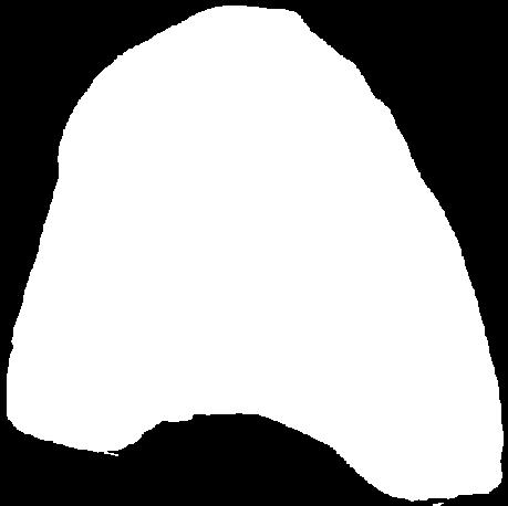 SZÍVSONKA    