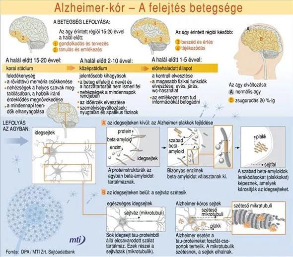 Etiológia Hátterében: az agy bizonyos