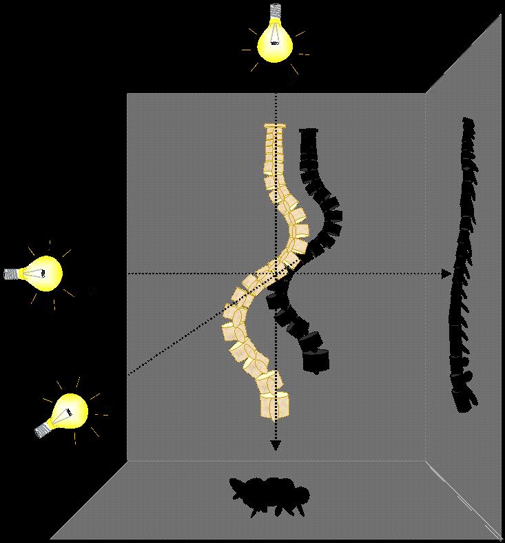 2. Irodalmi áttekintés 1. ábra. A 3D deformitás szemléltetése. Forrás: Csernátony Zoltán, Ph.D. értekezés 1999.