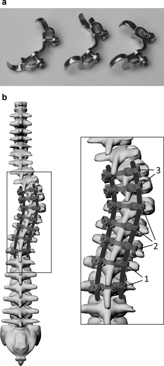 2 CSERNÁTONY ET AL. rib stumps to obtain information to aid in further implant development.