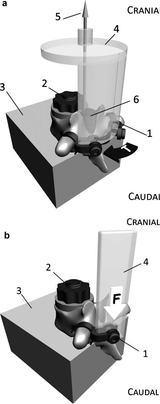 TRANSVERSE PROCESS LOADING CAPACITY 3 Table 1. Donor and Anatomic Information of the Thoracic Spine Specimens and Vertebral Pairs Specimen Thoracic Sections Gender Age (Years) 1. Th I-IX Female 72 2.