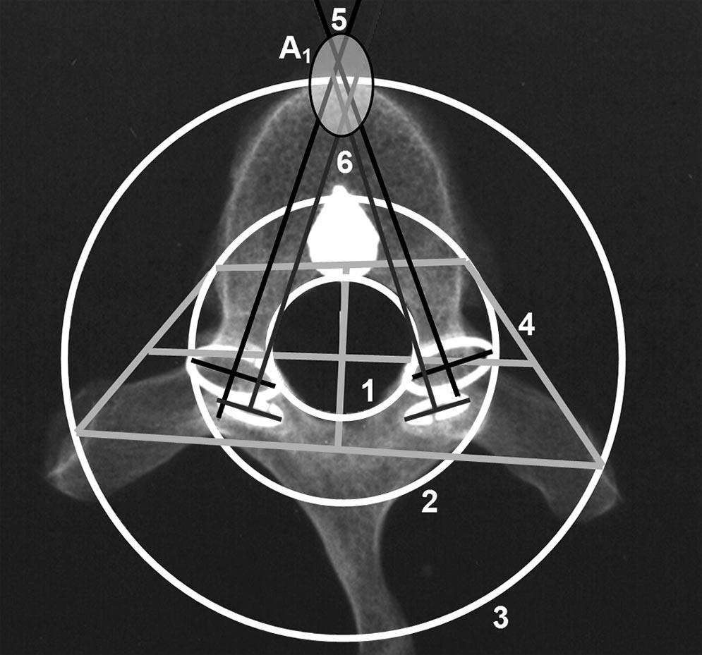 Ex Vivo and In Vitro Determination of the Axial Rotational Axis Molnár et al E985 Figure 1.