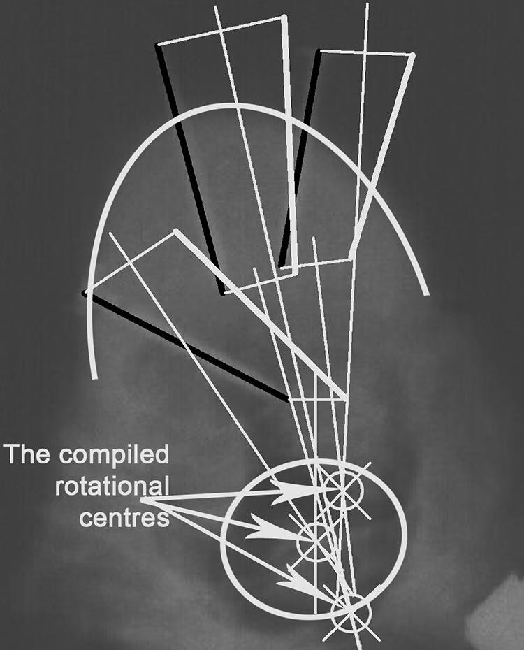 Ex Vivo and In Vitro Determination of the Axial Rotational Axis Molnár et al E987 Table 1. X-rays: Pattern of the Specimens With Rib Stubs X-ray No.