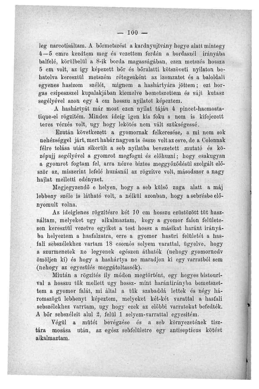 100 leg nareotisáltam.