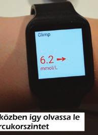 Még egy dolog A költségek tekintetében, ha a másik két rendszerrel (Medtronic, Dexcom) hasonlítjuk össze a támogatás nélküli ár esetében bőven a Libre vezet továbbra is!