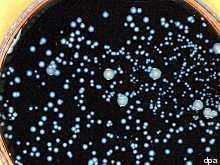 According to official reports, 2 people have died after contracting the rare condition legionnaires disease.