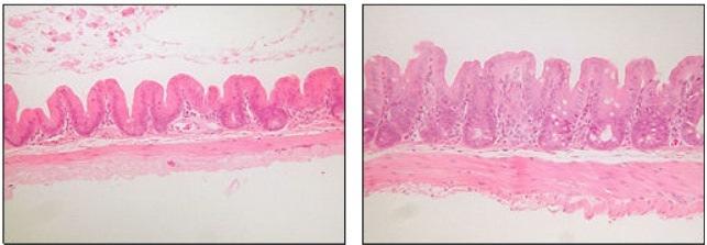 : The role of the microbiota in gastrointestinal health and