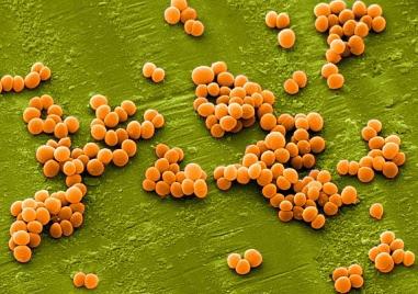 RÁGCSÁLÓK ÉS NYÚL TERJESZTETTE BAKTERIÁLIS ZOONÓZISOK STAPHYLOCOCCOSIS Kórokozó: Staphylococcus ssp, (pl. magas patogenitású S. aureus, apatogén S. epidermidis), G poz, koaguláztermelő.