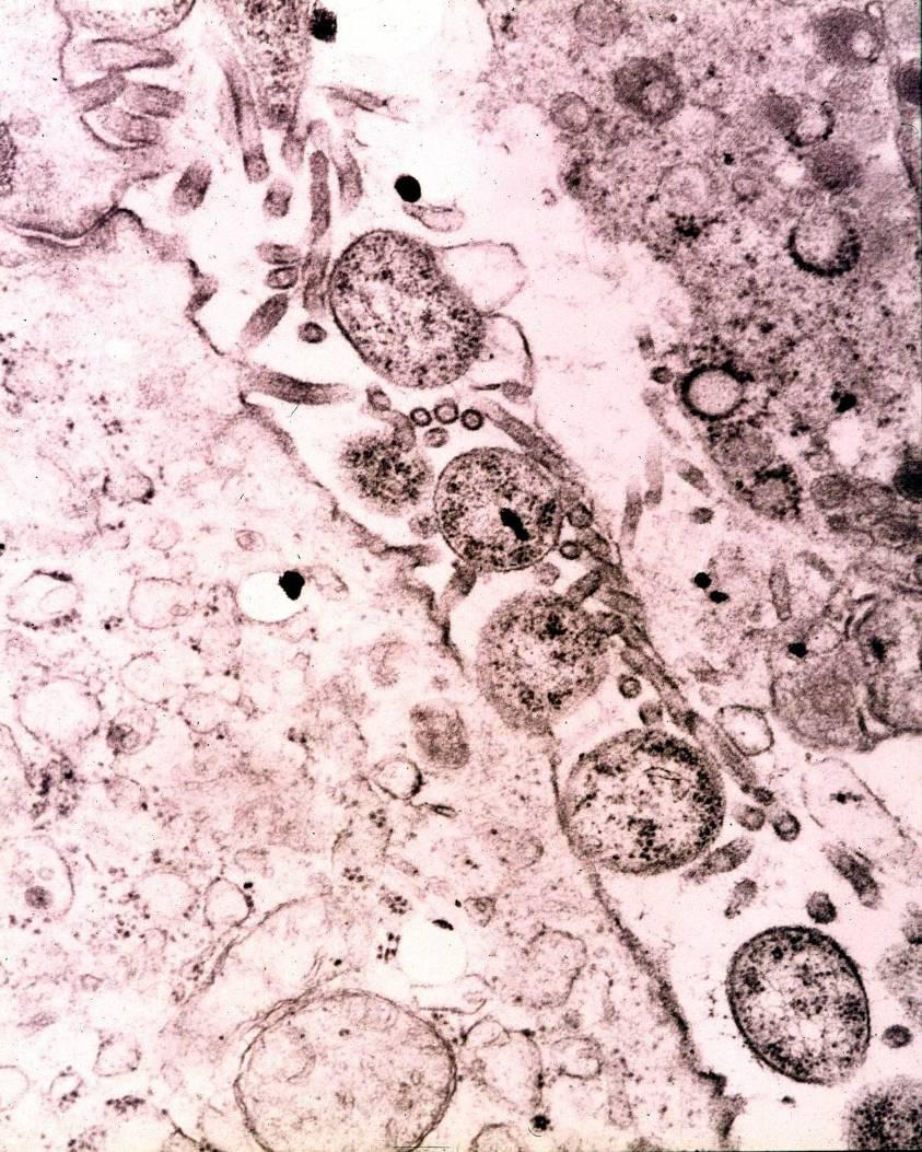 MYCOPLASMOSIS Betegség: Progresszív megbetegedés; H+V terjedés Kórokozó szoros kontaktusa az epithellel.