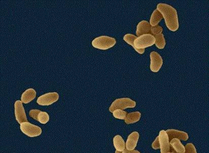 TULAREMIA - humán Kórokozó: Francisella tularensis Fertőzés forrása: fertőzött ember/labor állatok Rezervoár: nyúl; rágcsálók: patkány, egér, menyétfélék; birka,