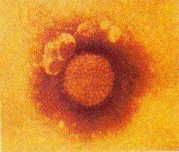RÁGCSÁLÓK ÉS NYÚL TERJESZTETTE VIRÁLIS ZOONÓZISOK Choriomeningitis lymphocytica LCMV Kórokozó: LCM vírus (Arenavírus; TERATOGÉN! vetélés, fejl.