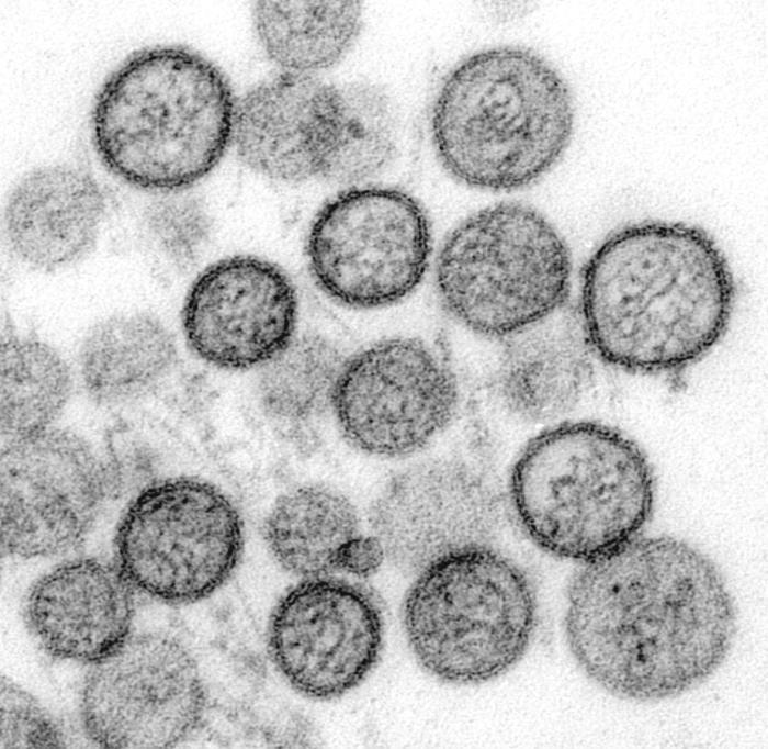 RÁGCSÁLÓK TERJESZTETTE VIRÁLIS ZOONÓZISOK HANTA HL - állat Kórokozó: Hanta vírus (Bunyaviridae család, RNS vírus Gazda: patkány, egér, humán (hordozás) Patogenitás: potenciális humán patogén,