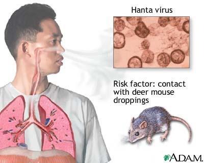 Hantavírus okozta megbetegedés - humán Légzőszervi forma: Pulmonalis szindrómával járó Hantavírus okozta megbetegedés (HPS) (ritka, súlyosabb lefolyású - Európában ) Fertőzés forrása: különböző