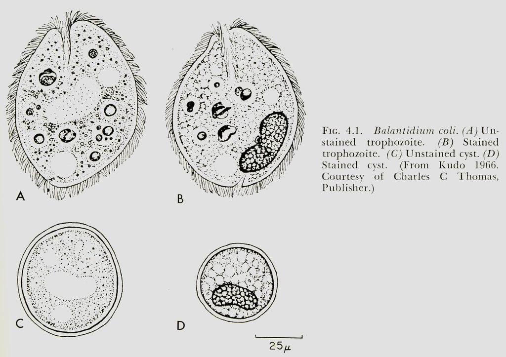 RÁGCSÁLÓK ÉS NYÚL TERJESZTETTE PROTOZOON ZOONÓZISOK (PARAZITÓZISOK) BALANTIDIUM COLI Jellemzők: A vastagbelek lakója. Nagy ciliata.