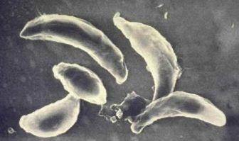 KUTYA, MACSKA TERJESZTETTE ZOONÓZISOK TOXOPLASMOSIS - humán Kórokozó: Toxoplasma gondii (TERATOGÉN!