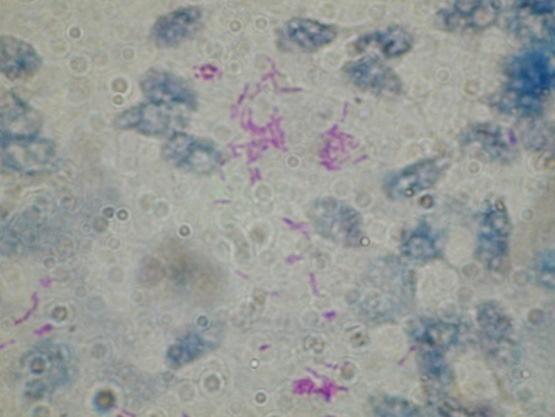 HALAK TERJESZTETTE ZOONÓZISOK Halgümőkór Kórokozó: Mycobacterium smegmatis, M.