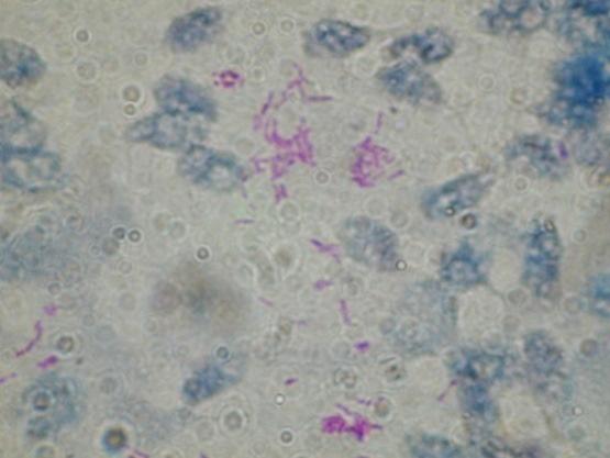 HALAK TERJESZTETTE ZOONÓZISOK Halgümőkór Kórokozó: Mycobacterium smegmatis, M.