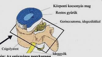 A BETEGSÉG NEVE: A GERINCOSZLOP INSTABILITÁSA AZ ÁGYÉKI ÉS A HÁTI GERINCSZAKASZON (instabilitás, sztenózis) A MŰTÉT NEVE: STABILIZÁCIÓ AZ ÁGYÉKI ÉS A HÁTI GERINCSZAKASZON (fúzió, rögzítés) KEDVES