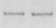 Western blot analízis, aorta WKY Kontroll FGY120 FGY400 TGFβ P-SMAD2 Ser465/467 Actin 12.ábra: Az FGY-1153 hatása a TGFβ/SMAD2 jelátviteli útvonalra az aorta falban.