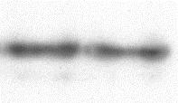 Western blot analízis, aorta WKY Kontroll FGY120 FGY400 P-Akt Ser473 P-GSK-3β Ser9 Actin * 15.ábra: Az FGY-1153 hatása az Akt/GSK-3β szignalizációs kaszkádra az aorta falban.