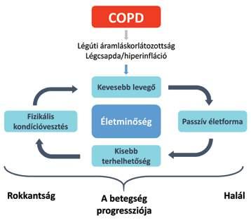 2017. február SZPONZORÁLT KÖZLEMÉNY 27 A krónikus obstruktív tüdőbetegségben zajló gyulladás jellemzői Dr.