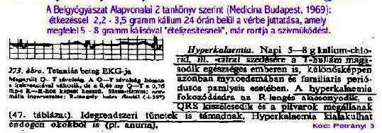 Iratjel:
