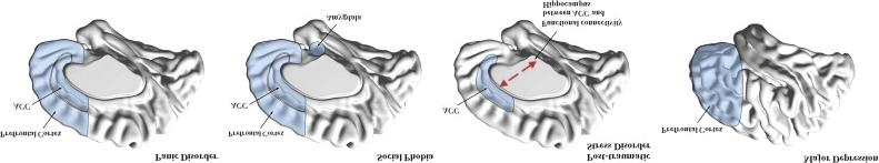 Visualized using the brain surface of the BrainNet Viewer (http://www.nitrc.org/projects/bnv).