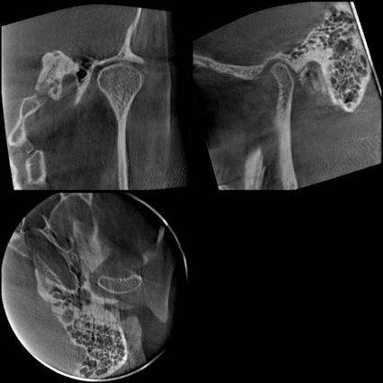 12 cm 6 cm 28,26mm 2
