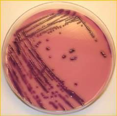 Kórokozók organizmus Staph. Aureus 75-80% Streptococcus Neisseria gonorrh. Aerob gram +- B.