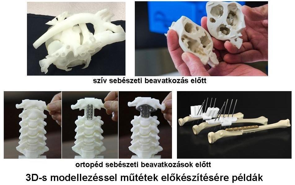 Kísérletek folynak a szervek 3D-s bionyomtatóval való elkészítésére.