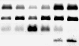 Figure A B C D E F Vimentin (200 bp) Nestin (220 bp) NGN2 (196 bp) N-tubulin