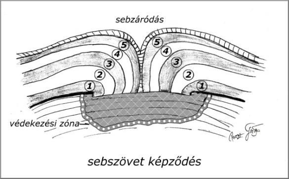 VIZUÁLIS ÉS MŰSZERES FAVIZSGÁLATI ÚTMUTATÓ A sebszövet képződéséhez fontos a tápanyagokkal való ellátás, a levegő magas páratartalma és a kielégítő oxigénellátás.