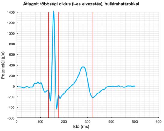 WIWE Szívből jövő üzenet! 1. Normál EKG paraméterektől való eltérés 2.