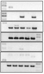 A B 1: MW 2: Isreco-1 3: Isreco-2 4: Isreco-3 5: Normál colon epithél sejt 6: HeLa 7: Kontroll 1. ábra. Konstitutív citokin termelés tumor sejtekben.