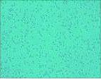 + SDF-1α + médium 3. ábra. HeLa sejtek kemotaxisa SDF-1α kezelés hatására A B Isreco-1 0.015 PQA1 (pg) 0.010 0.005 PQA1: kompetitor DNS C 0.000 Isreco-1 NCES 4. ábra. SDF-1α hatása colorectális daganatsejtek és normál colon epitheliális sejtek (NCES) IL-8 termelésére.