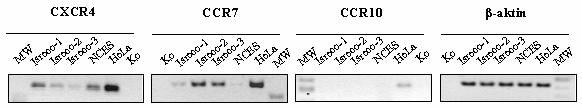 Isreco-1 Isreco-2 anti-cxcr4 kontroll