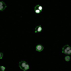 daganatsejteken, normál colon epitheliális