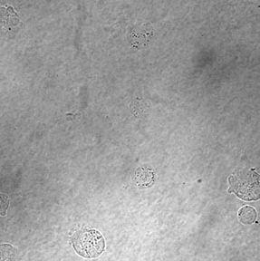 (zöld: CXCR4, fehér: DAPI/sejtmag, konfokális
