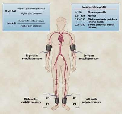 A boka/kar index (ankle/brachial index, ABI) meghatározása