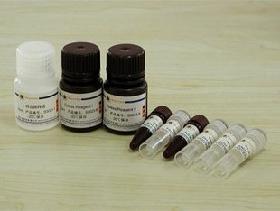 Vegyszerek: UDV0101 Nátrium dodecil szulfát (SDS) 99% 1 kg UDV0103 Acrylamide 500 g UDV0104 Bis-acrylamide 100 g UDV0102 Tris Base 1 kg UDV0201 Guanidine thiocyanate 100 g UDV0103 DL-Dithiothreitol 5