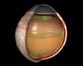 Vitrectomia Műtét közben retina stabilizálása,